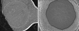 Figure 4. SEM images showing the surface of a capture pad (left) after separation from the bottom of a blind via (right).